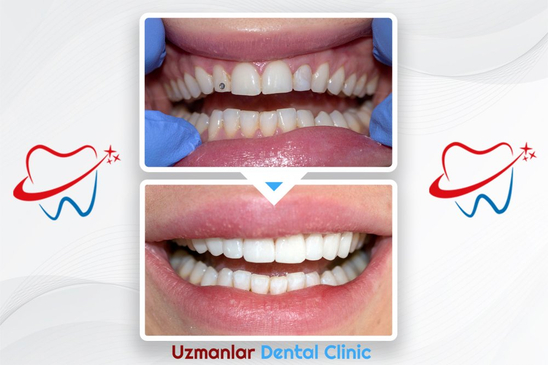 Slider image (9) Uzmanlar Dental Clinic
